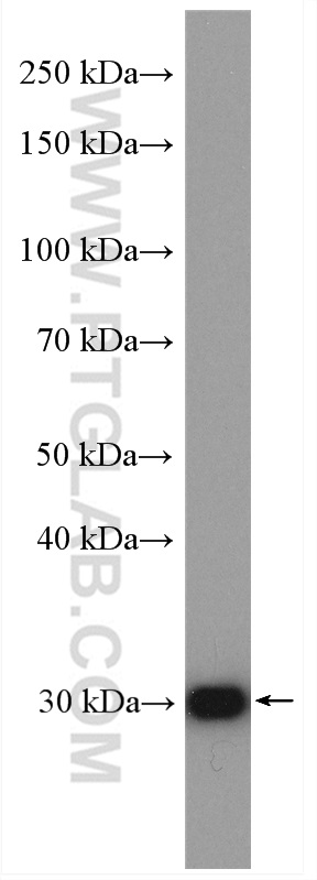 WB analysis of mouse kidney using 10393-1-AP