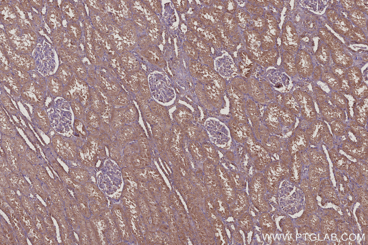 IHC staining of human kidney using 67043-1-Ig