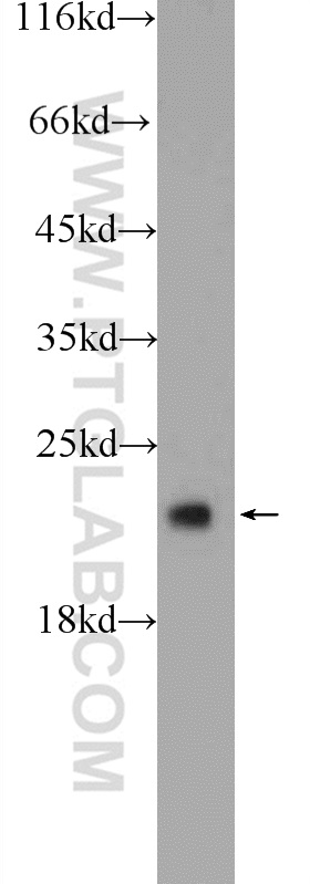 WB analysis of HEK-293 using 25237-1-AP