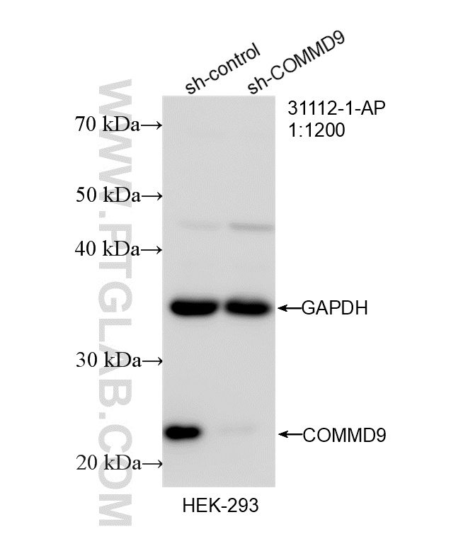 WB result of COMMD9 antibody (31112-1-AP; 1:1200; incubated at room temperature for 1.5 hours) with sh-Control and sh-COMMD9 transfected HEK-293 cells. WB analysis of HEK-293 using 31112-1-AP