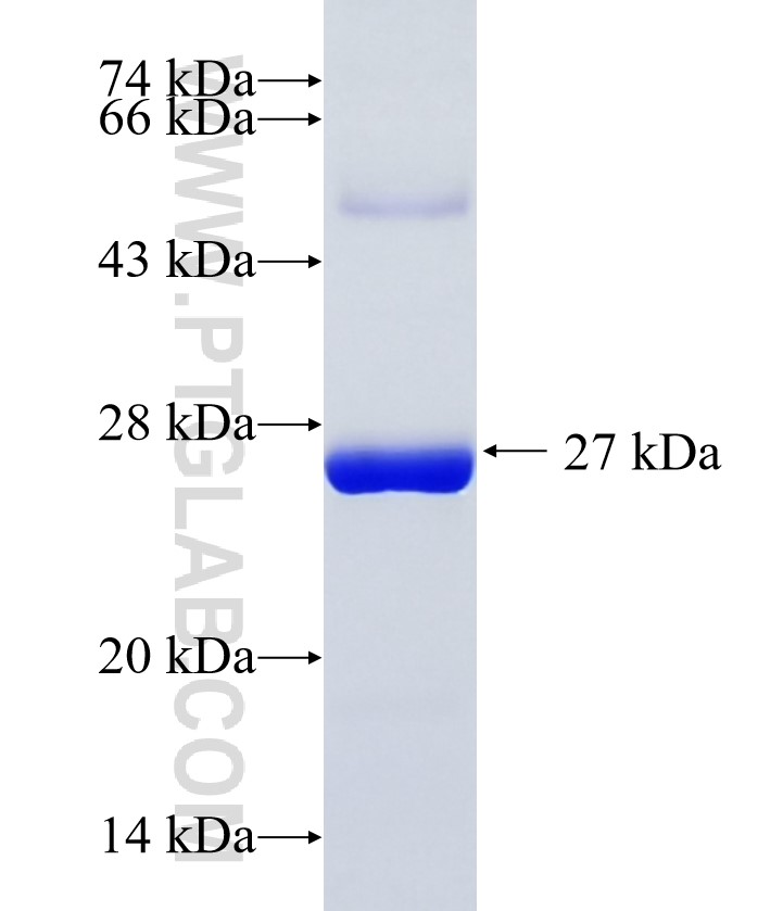 COMMD9 fusion protein Ag35344 SDS-PAGE COMMD9 fusion protein Ag35344 SDS-PAGE