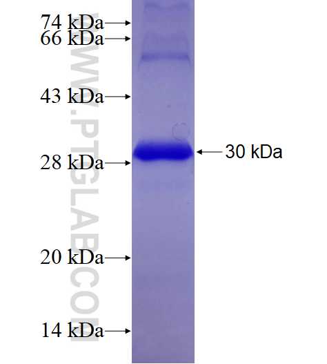 COMP fusion protein Ag28749 SDS-PAGE