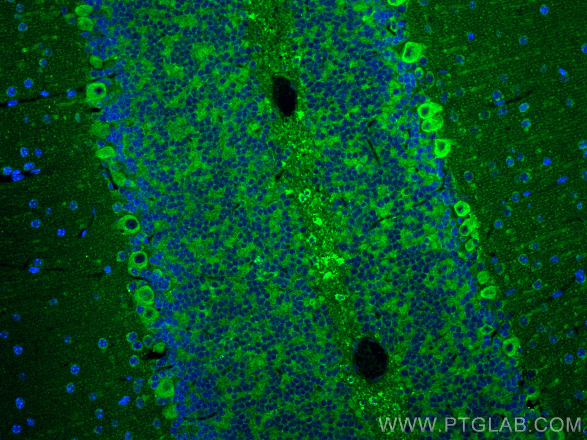 IF Staining of mouse cerebellum using 14754-1-AP