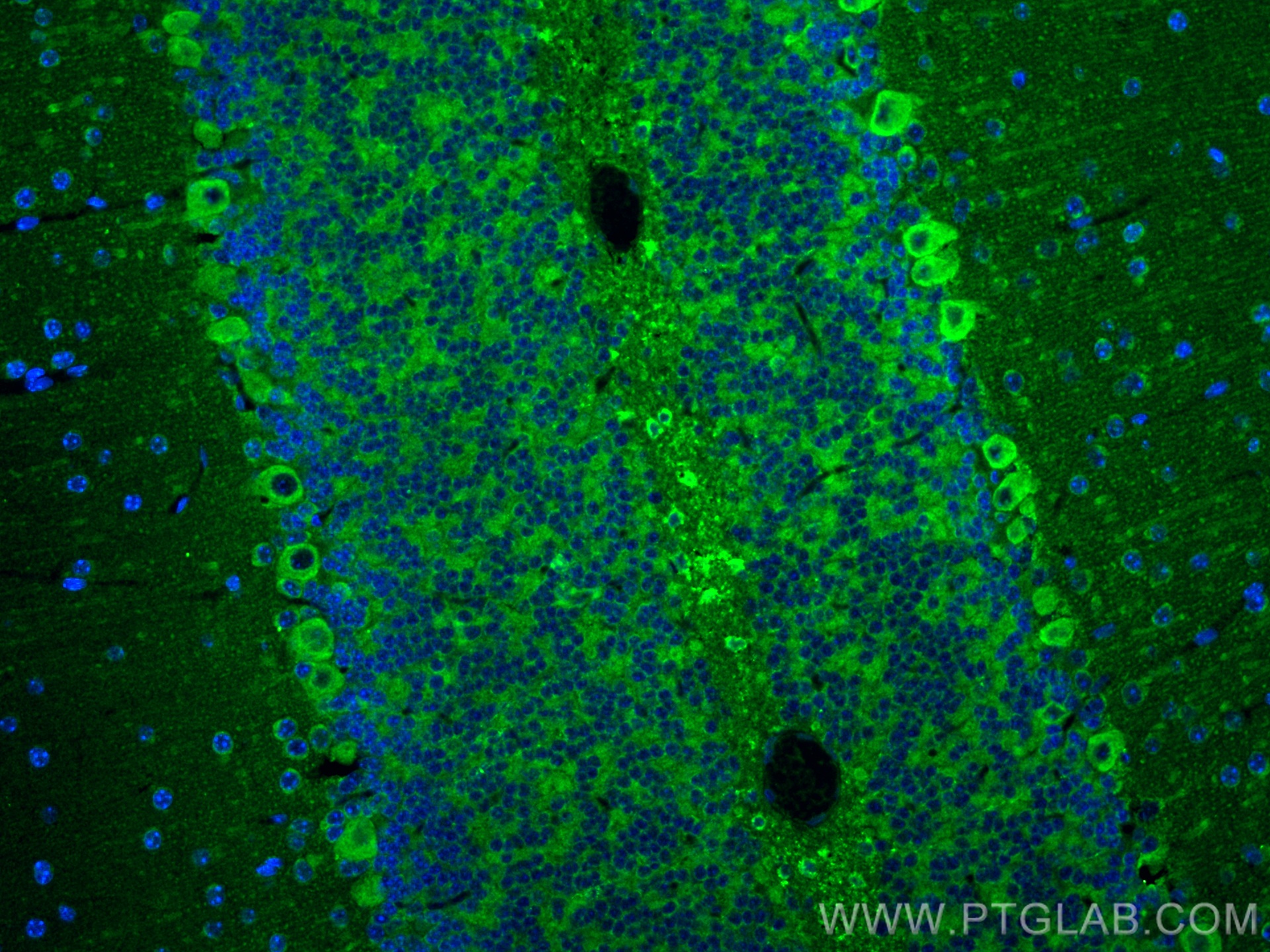 IF Staining of mouse cerebellum using 14754-1-AP