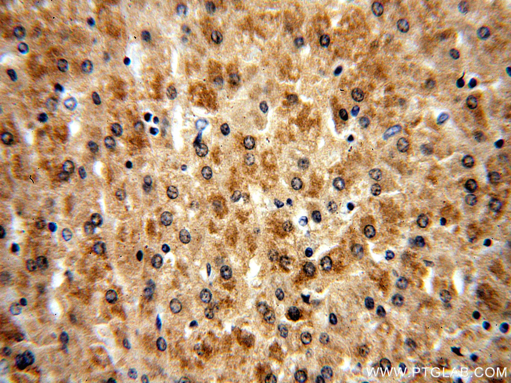 IHC staining of human liver using 14754-1-AP