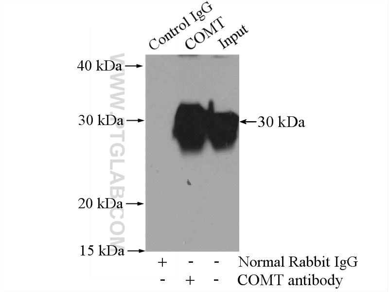 IP experiment of K-562 using 14754-1-AP