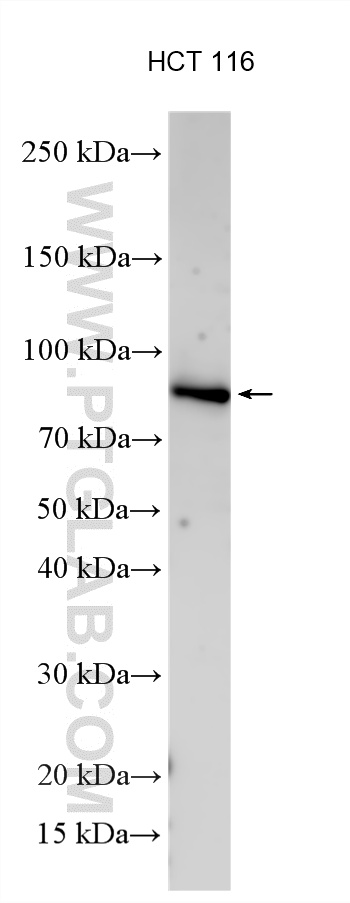WB analysis using 28395-1-AP