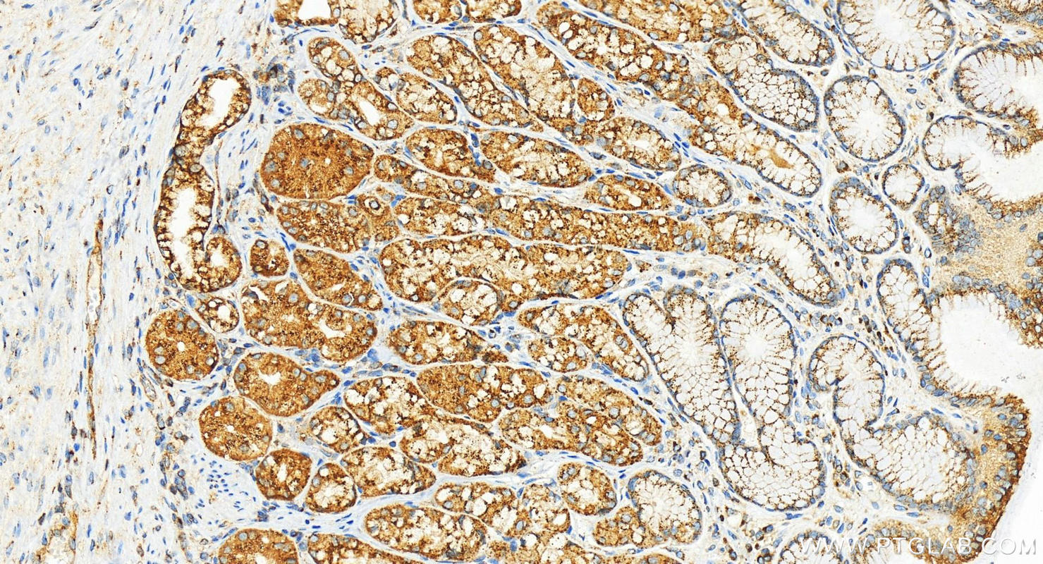 IHC staining of human stomach using 83089-1-RR (same clone as 83089-1-PBS)