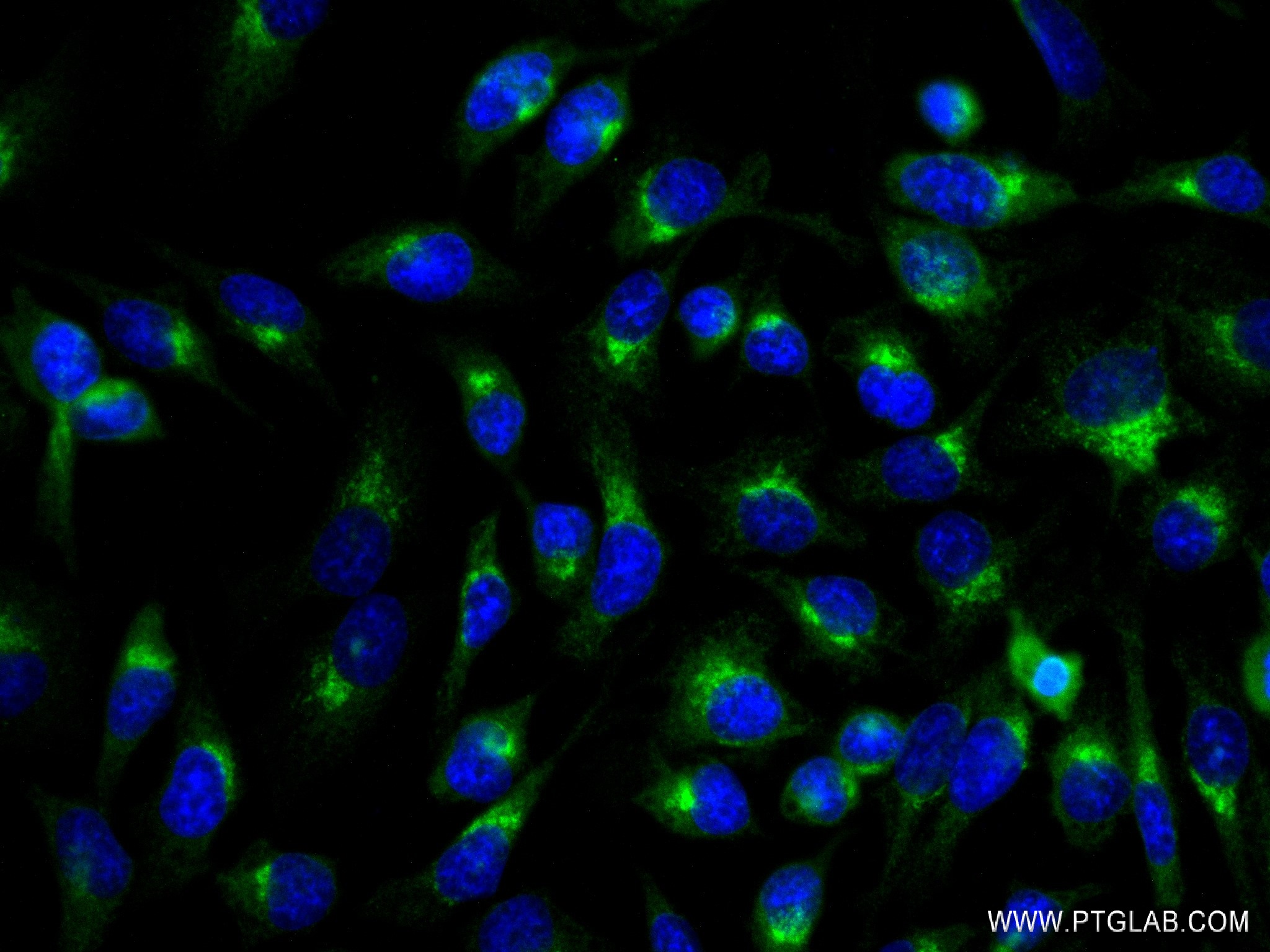 IF Staining of HeLa using 83089-1-RR (same clone as 83089-1-PBS)