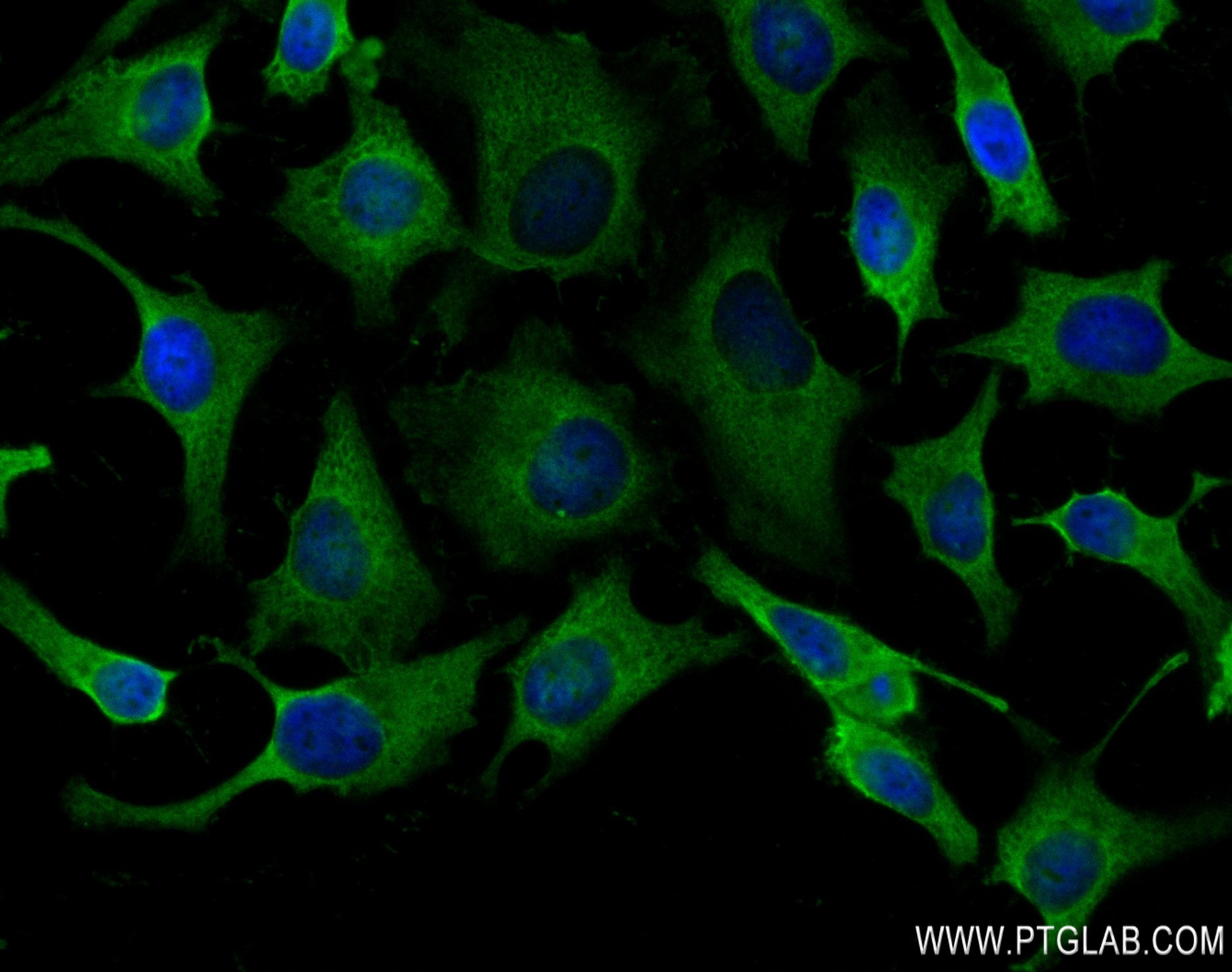 IF Staining of HeLa using 83089-2-RR