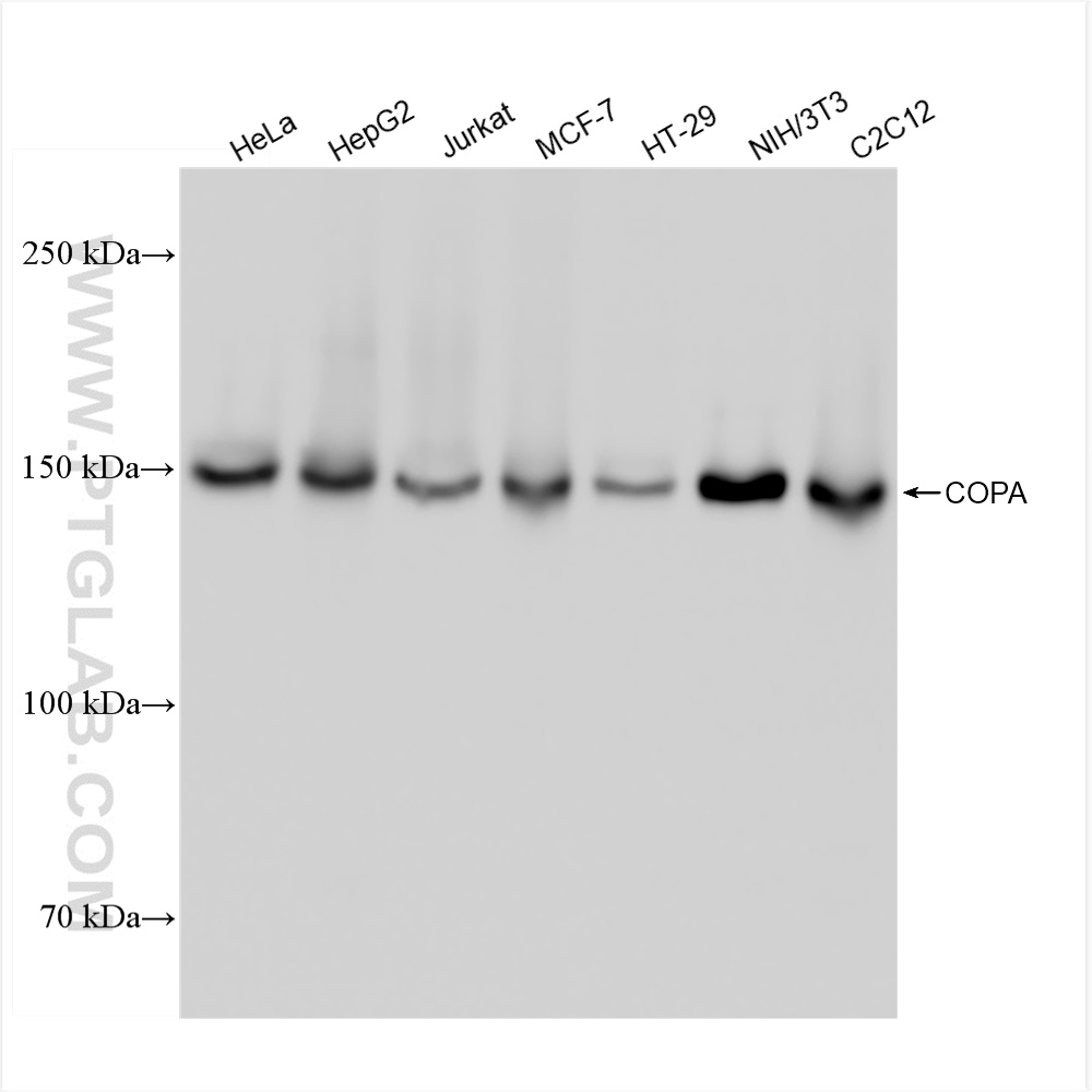 WB analysis using 83089-2-RR