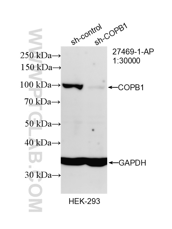 WB analysis of HEK-293 using 27469-1-AP WB analysis of HEK-293 using 27469-1-AP