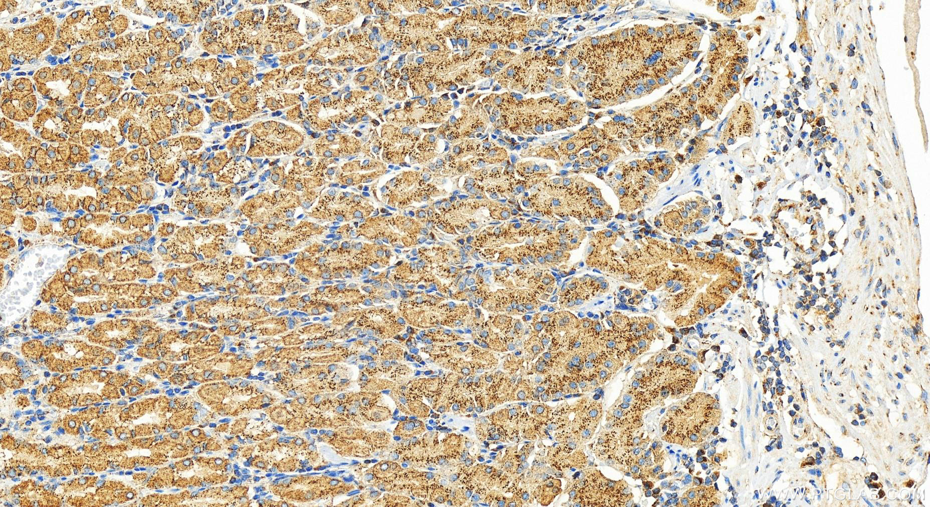 IHC staining of human stomach using 14733-1-AP