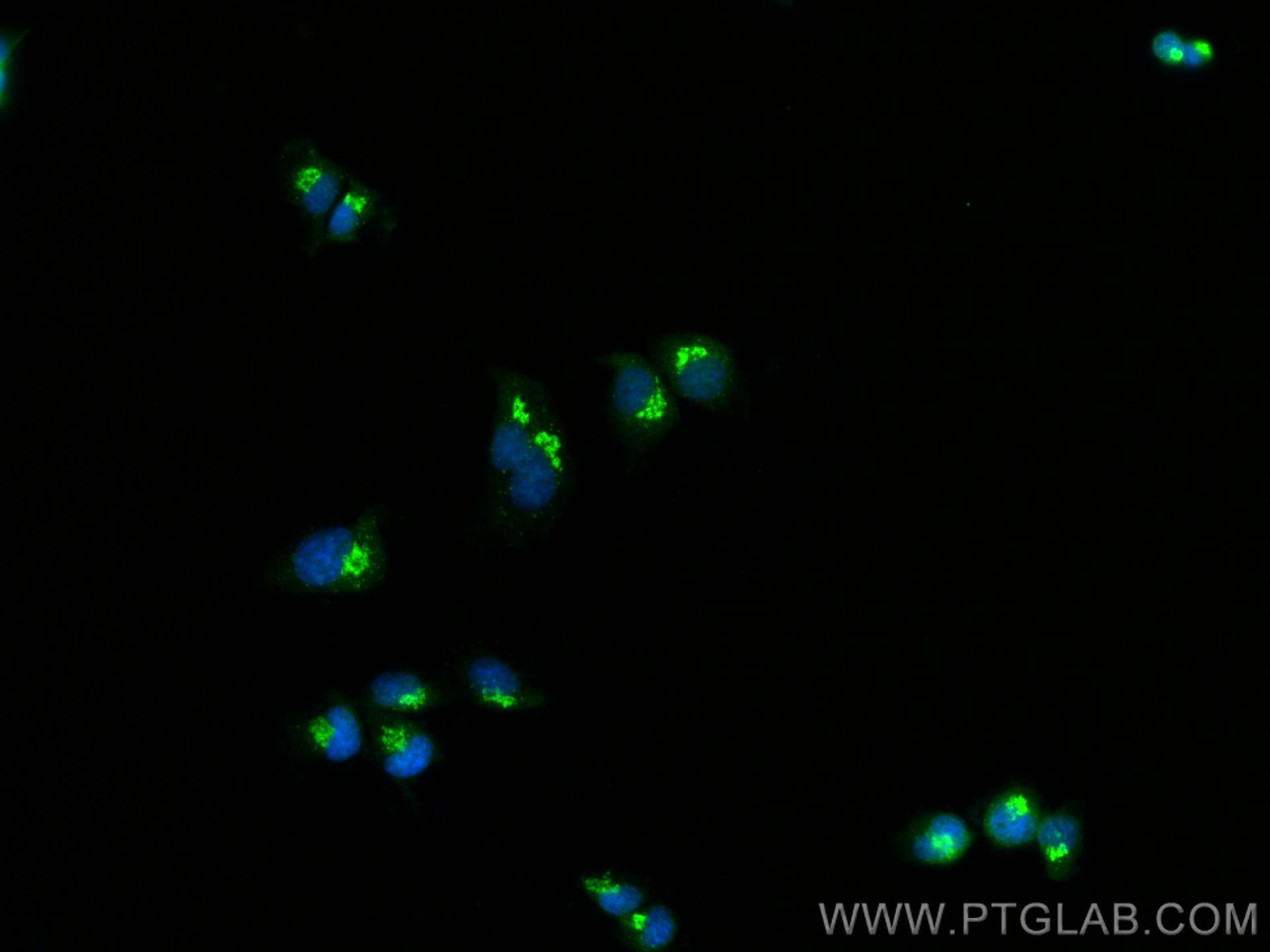 IF Staining of PC-12 using 14733-1-AP