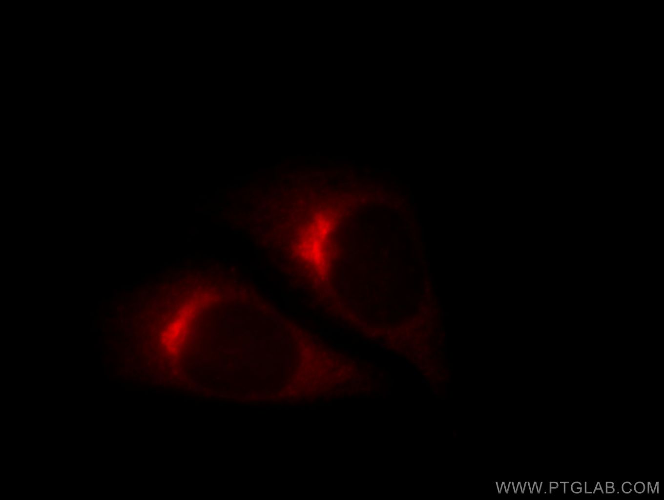 COPE Polyclonal antibody