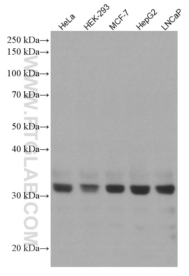 WB analysis using 66994-1-Ig