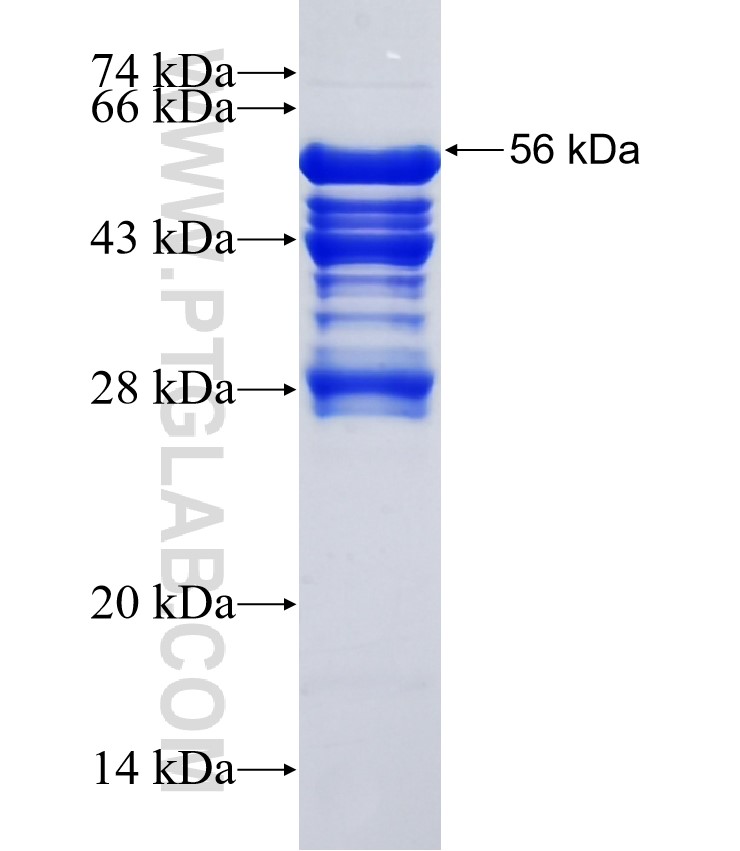COPRS fusion protein Ag35439 SDS-PAGE COPRS fusion protein Ag35439 SDS-PAGE