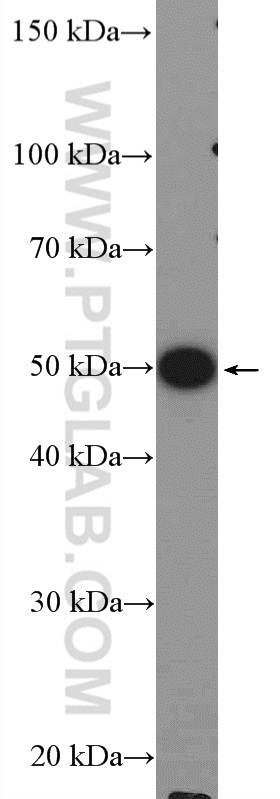 WB analysis of HeLa using 10969-2-AP