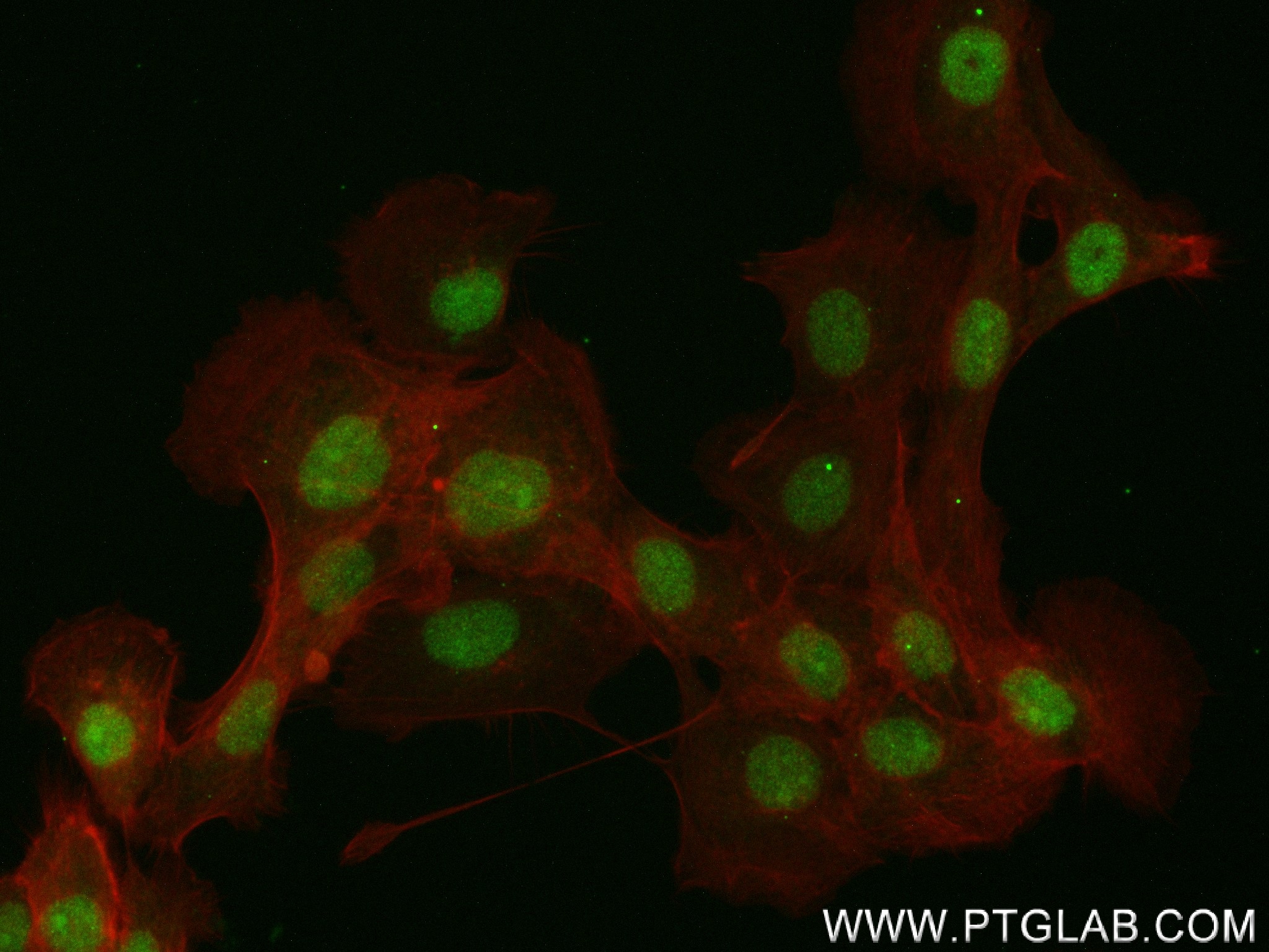 IF Staining of A431 using 83822-2-RR