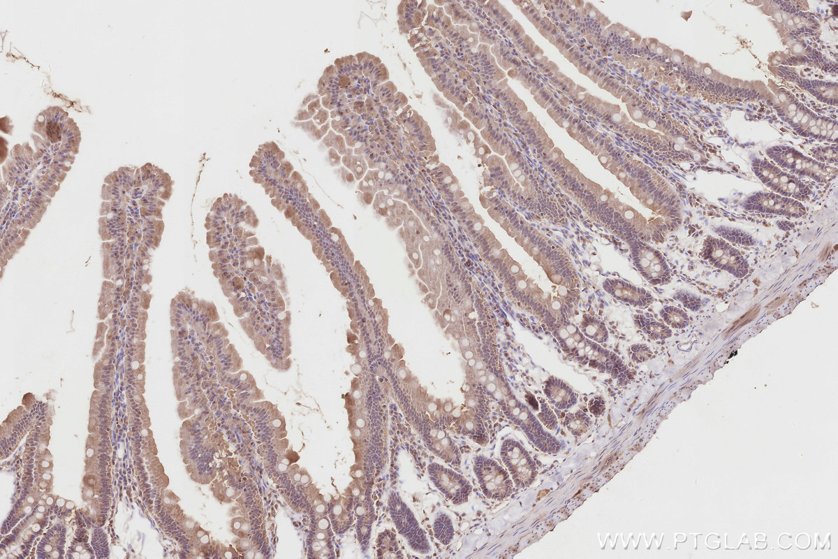 IHC staining of rat small intestine using 10464-1-AP IHC staining of rat small intestine using 10464-1-AP