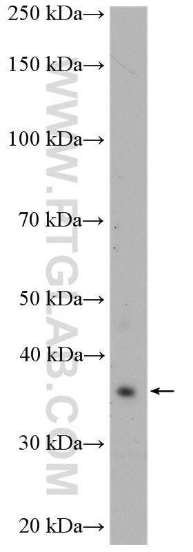 WB analysis of 3T3-L1 using 10256-1-AP