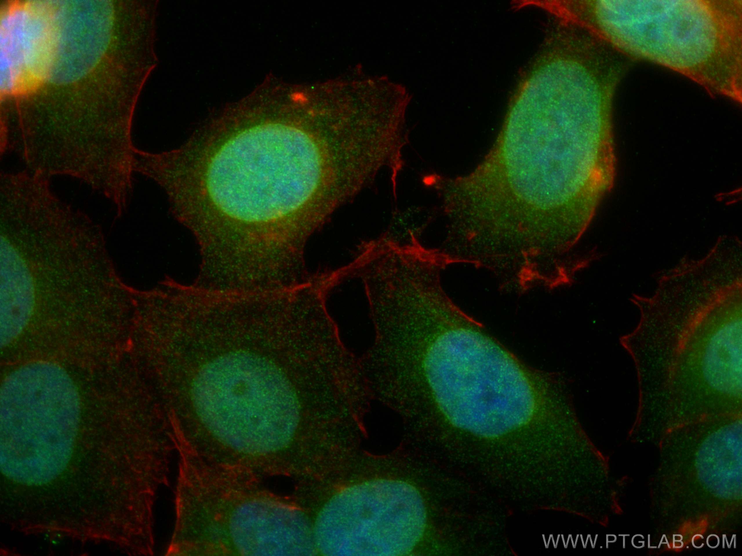 IF Staining of MCF-7 using 16628-1-AP