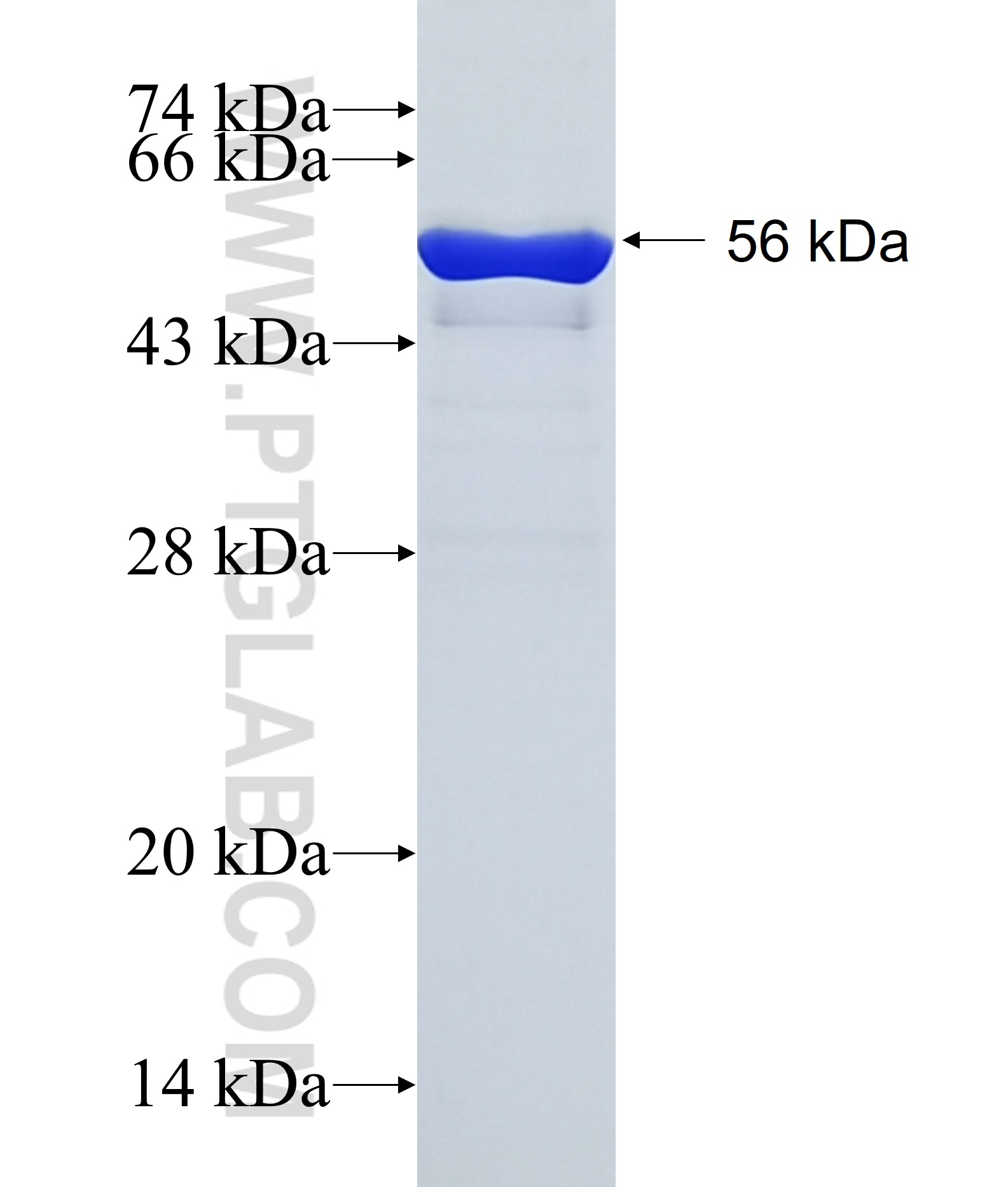 COPS7A fusion protein Ag9958 SDS-PAGE