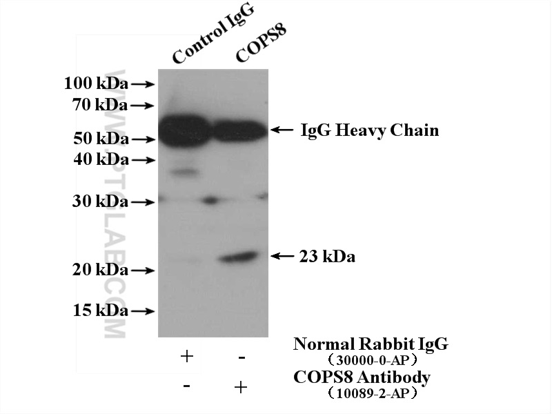 IP experiment of mouse brain using 10089-2-AP