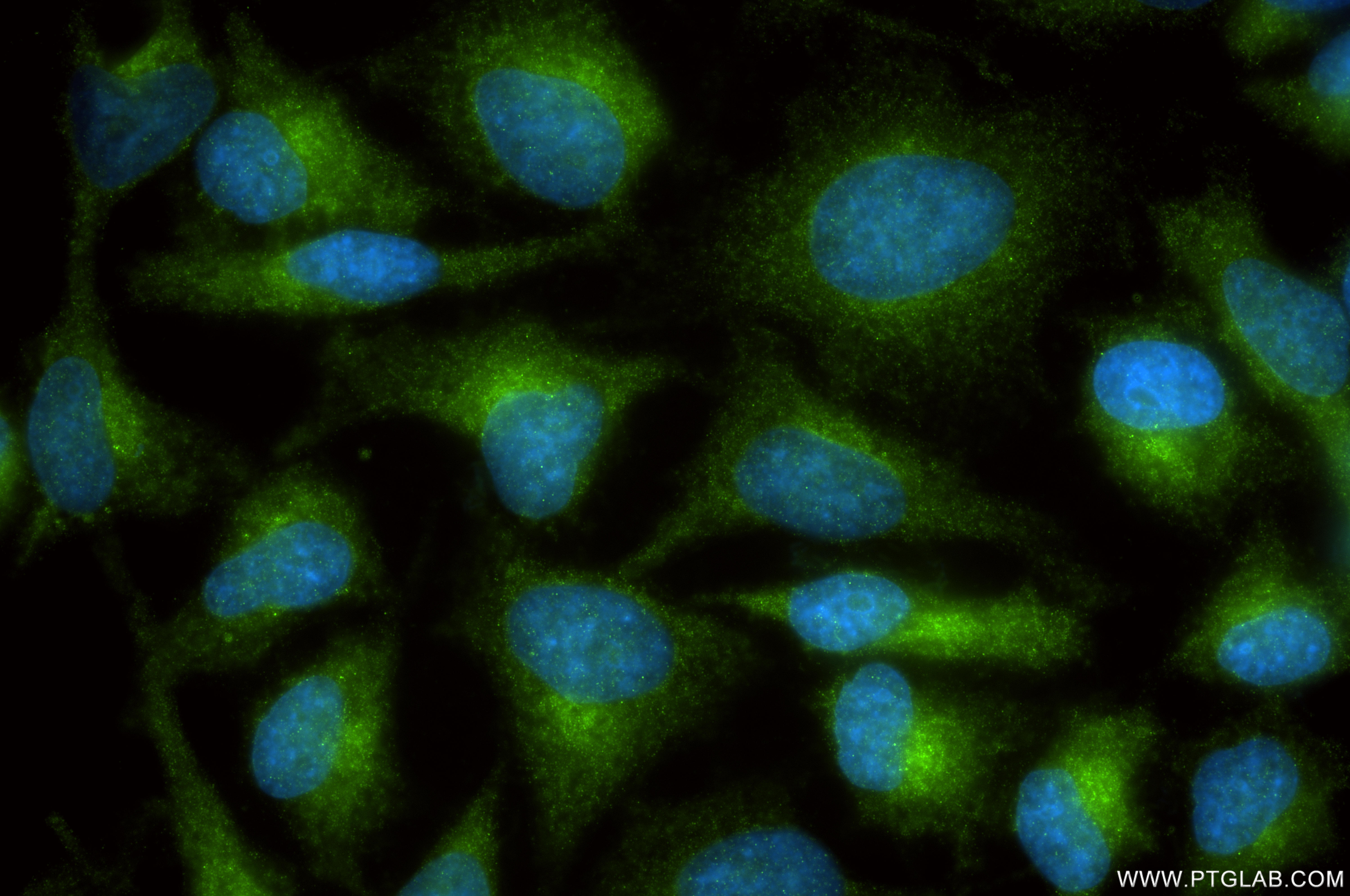IF Staining of HeLa using 86014-1-RR