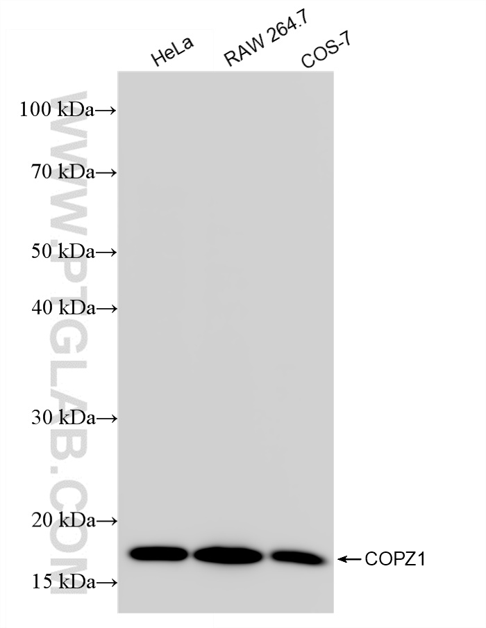 WB analysis using 86014-1-RR (same clone as 86014-1-PBS)
