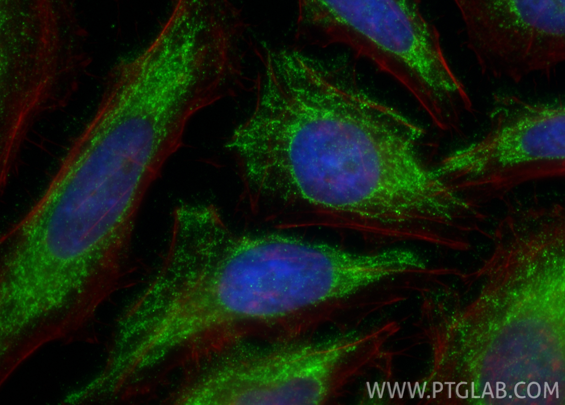 Immunofluorescent analysis of (-20°C Ethanol) fixed HeLa cells using COQ10A antibody (17812-1-AP) at dilution of 1:200 and CoraLite®488-Conjugated Goat Anti-Rabbit IgG(H+L) (<a class='green' href='/productredirect?CatalogNo=SA00013-2' target='_blank'>SA00013-2</a>), CL594-phalloidin (red). IF Staining of HeLa using 17812-1-AP