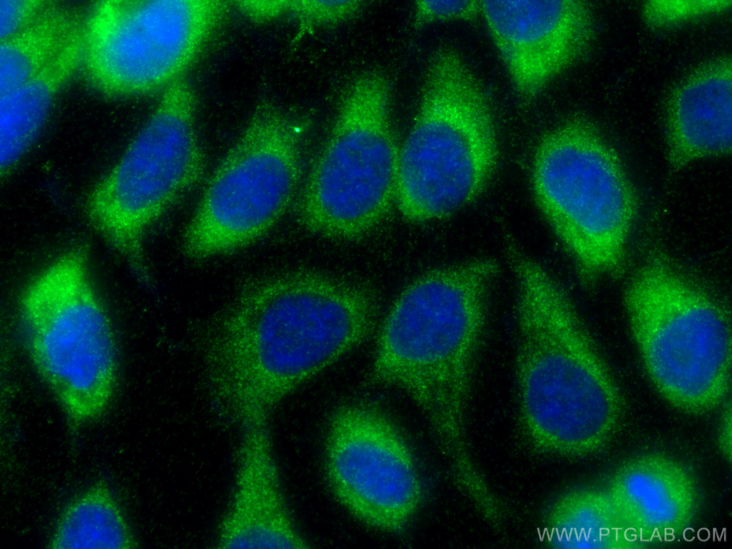 IF Staining of A431 using 17269-1-AP (same clone as 17269-1-PBS)