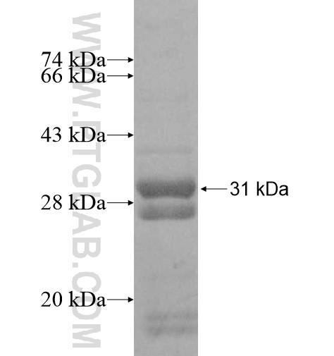 COQ10B fusion protein Ag11024 SDS-PAGE