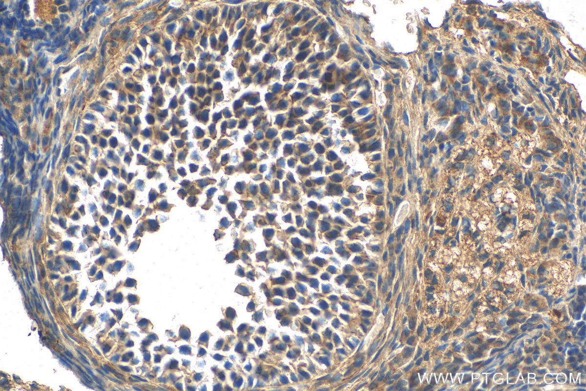 IHC staining of mouse ovary using 12481-1-AP (same clone as 12481-1-PBS)
