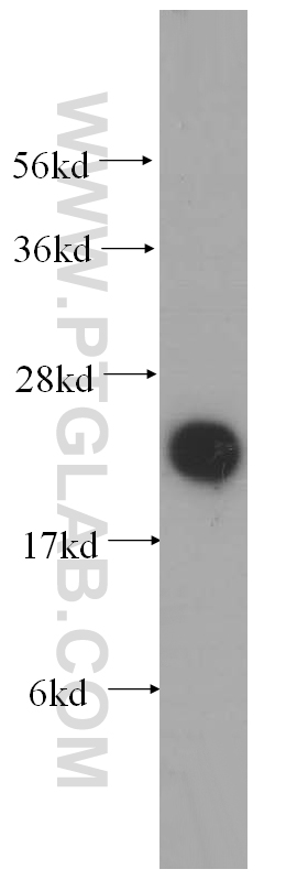 WB analysis of mouse liver using 15083-1-AP