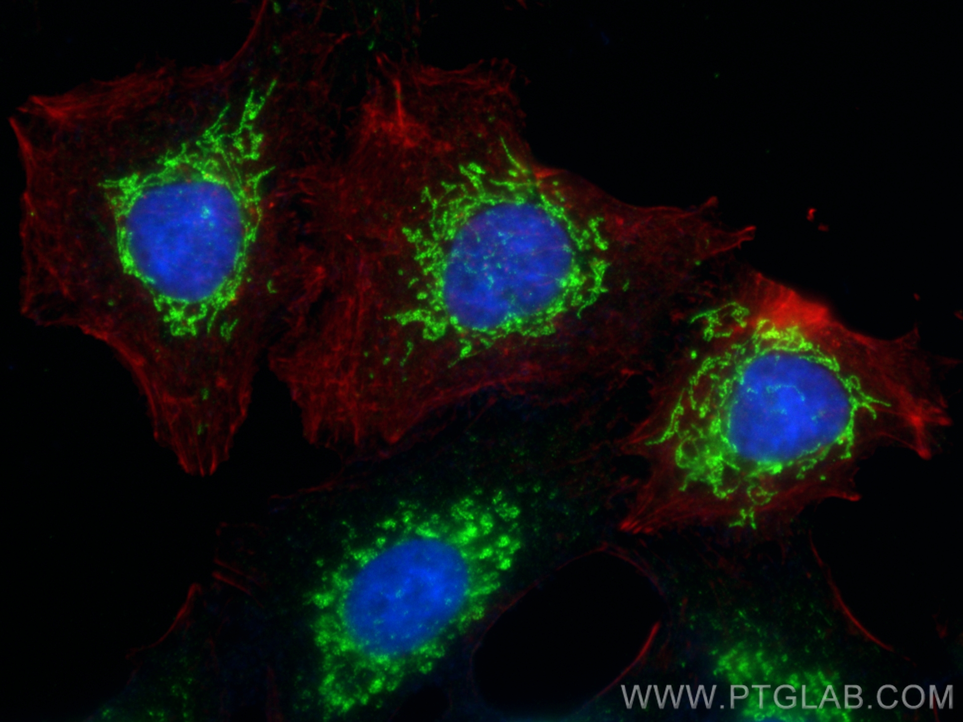 IF Staining of A549 using 14874-1-AP