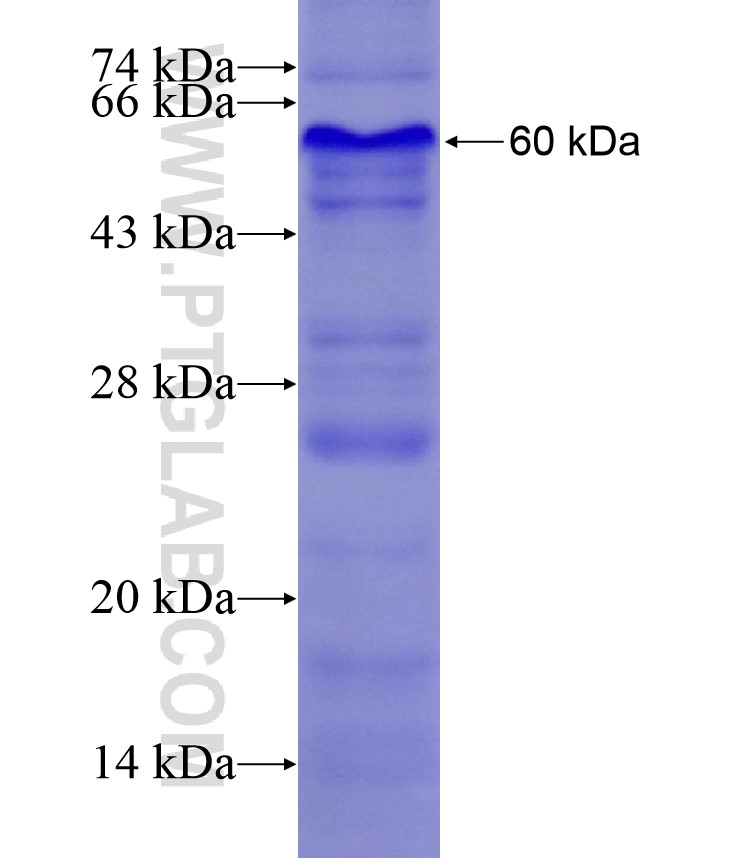 CORIN fusion protein Ag17059 SDS-PAGE CORIN fusion protein Ag17059 SDS-PAGE