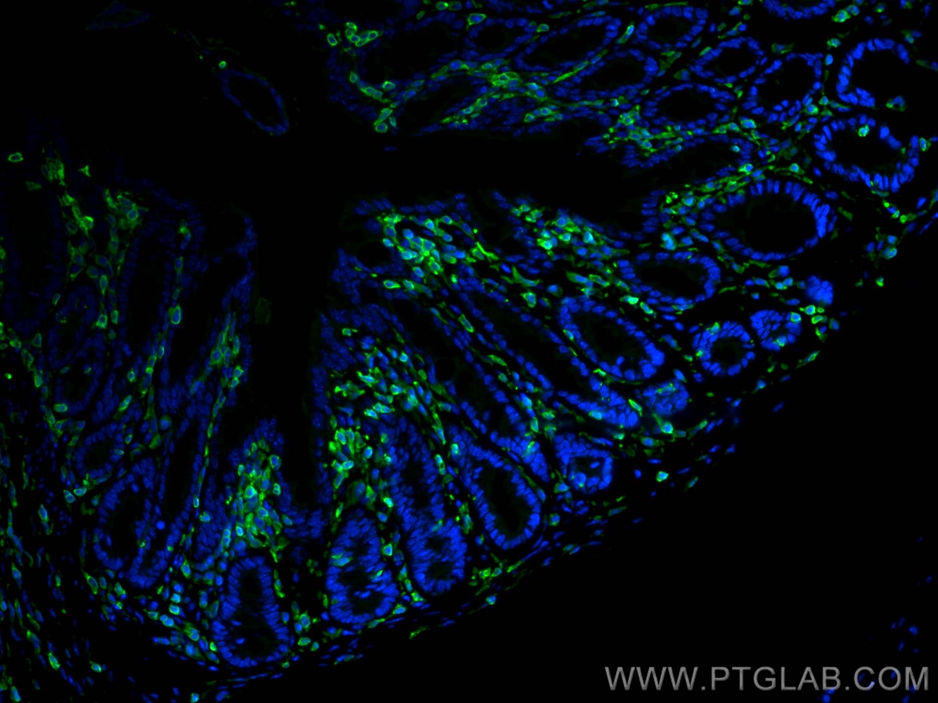 IF Staining of mouse colon using 17760-1-AP
