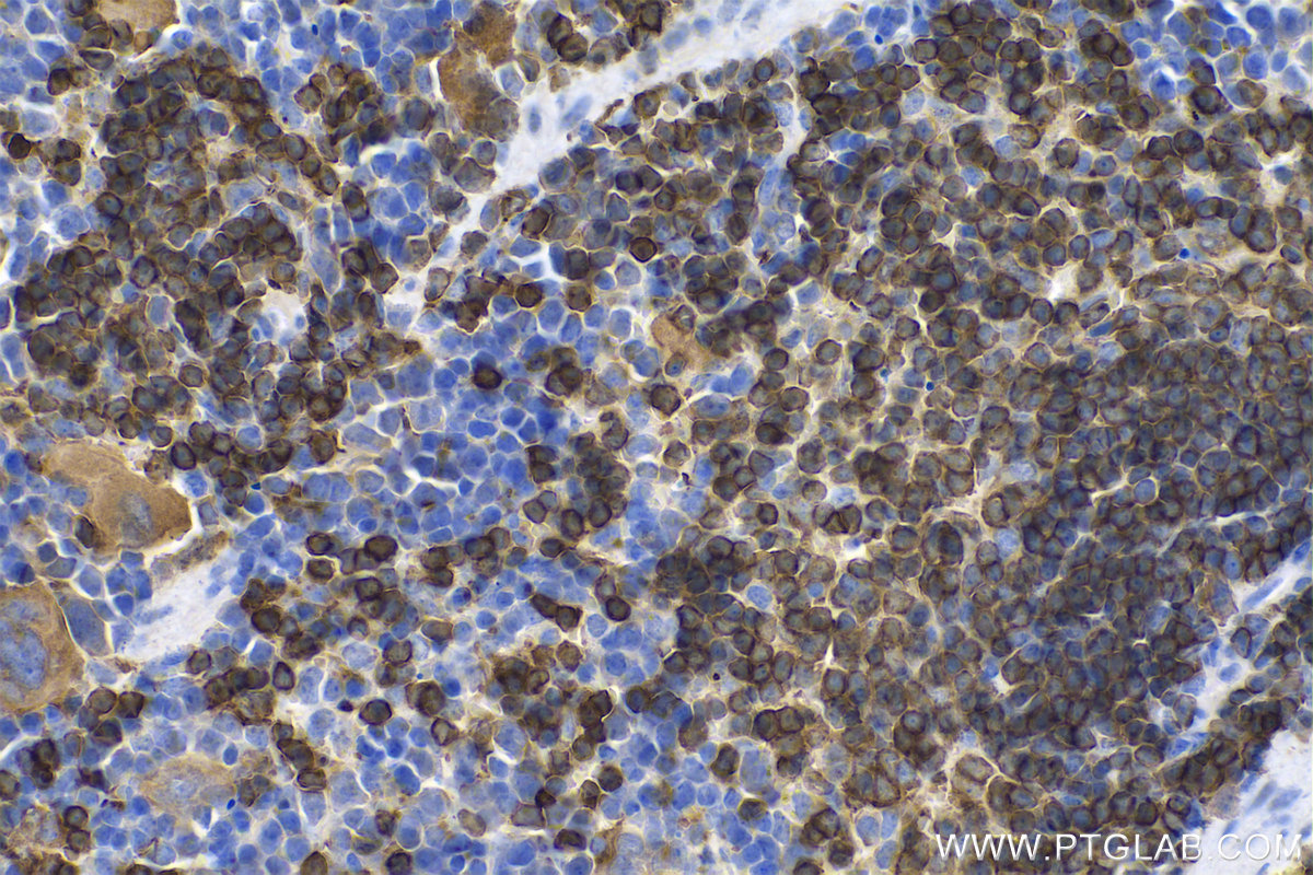 IHC staining of mouse spleen using 17760-1-AP