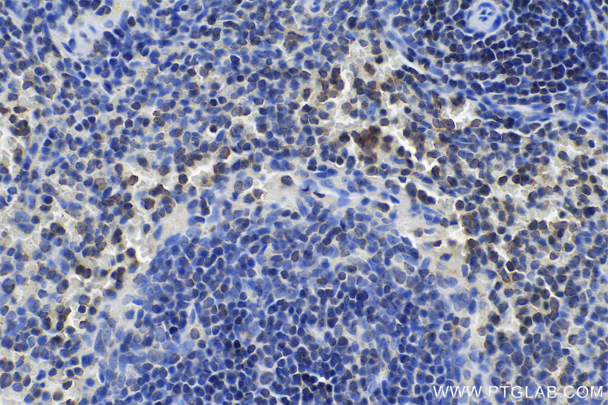 IHC staining of rat spleen using 17760-1-AP