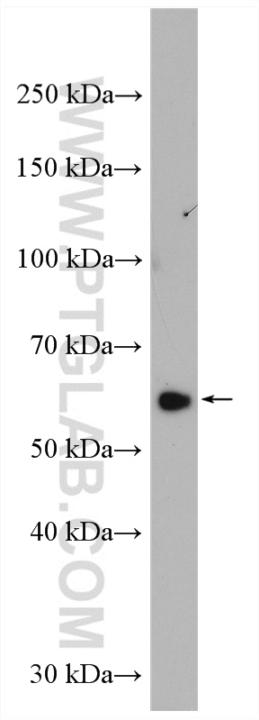 WB analysis of rat brain using 17760-1-AP