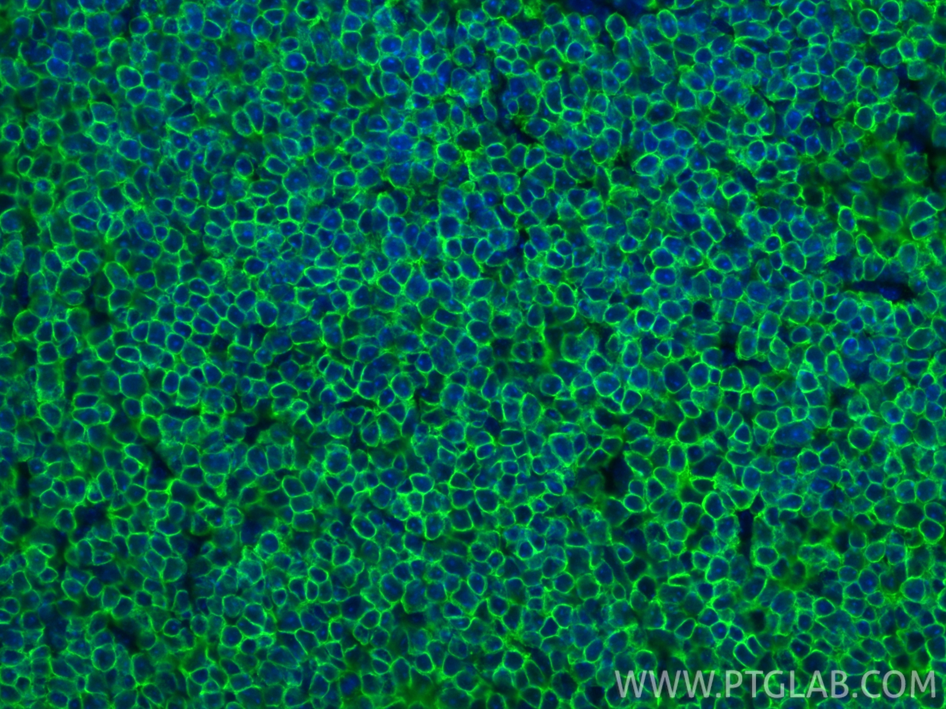 IF Staining of mouse spleen using RMX00049