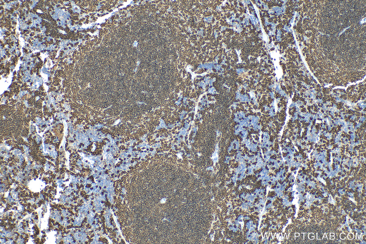 IHC staining of mouse spleen using RMX00049