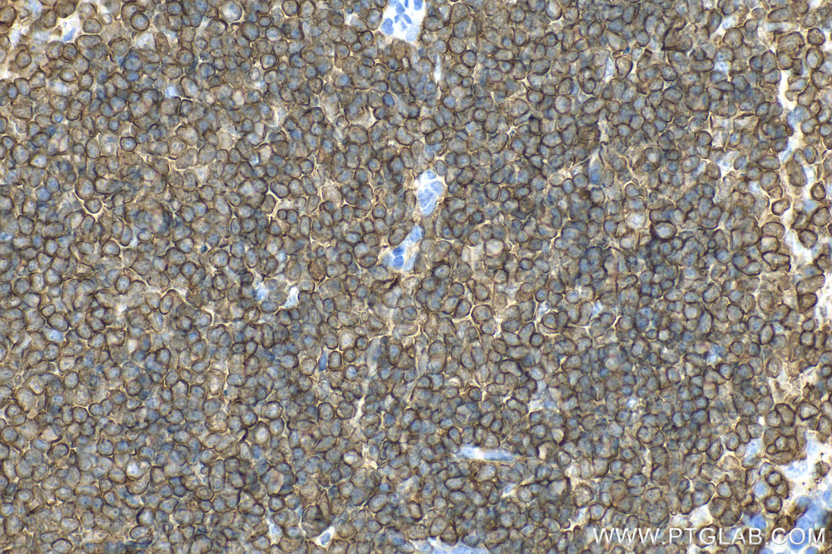 IHC staining of mouse spleen using RMX00049