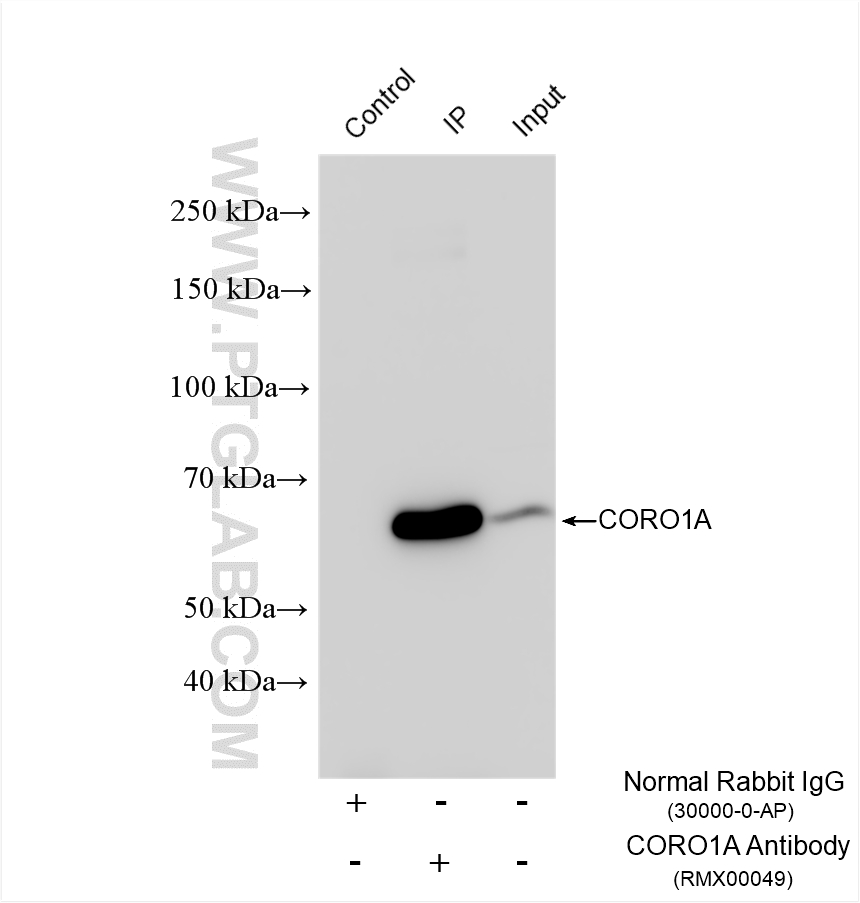 IP experiment of mouse brain using RMX00049