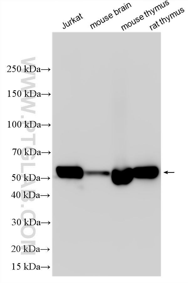WB analysis using RMX00049
