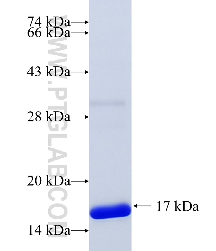 CORO1B fusion protein Ag35134 SDS-PAGE CORO1B fusion protein Ag35134 SDS-PAGE