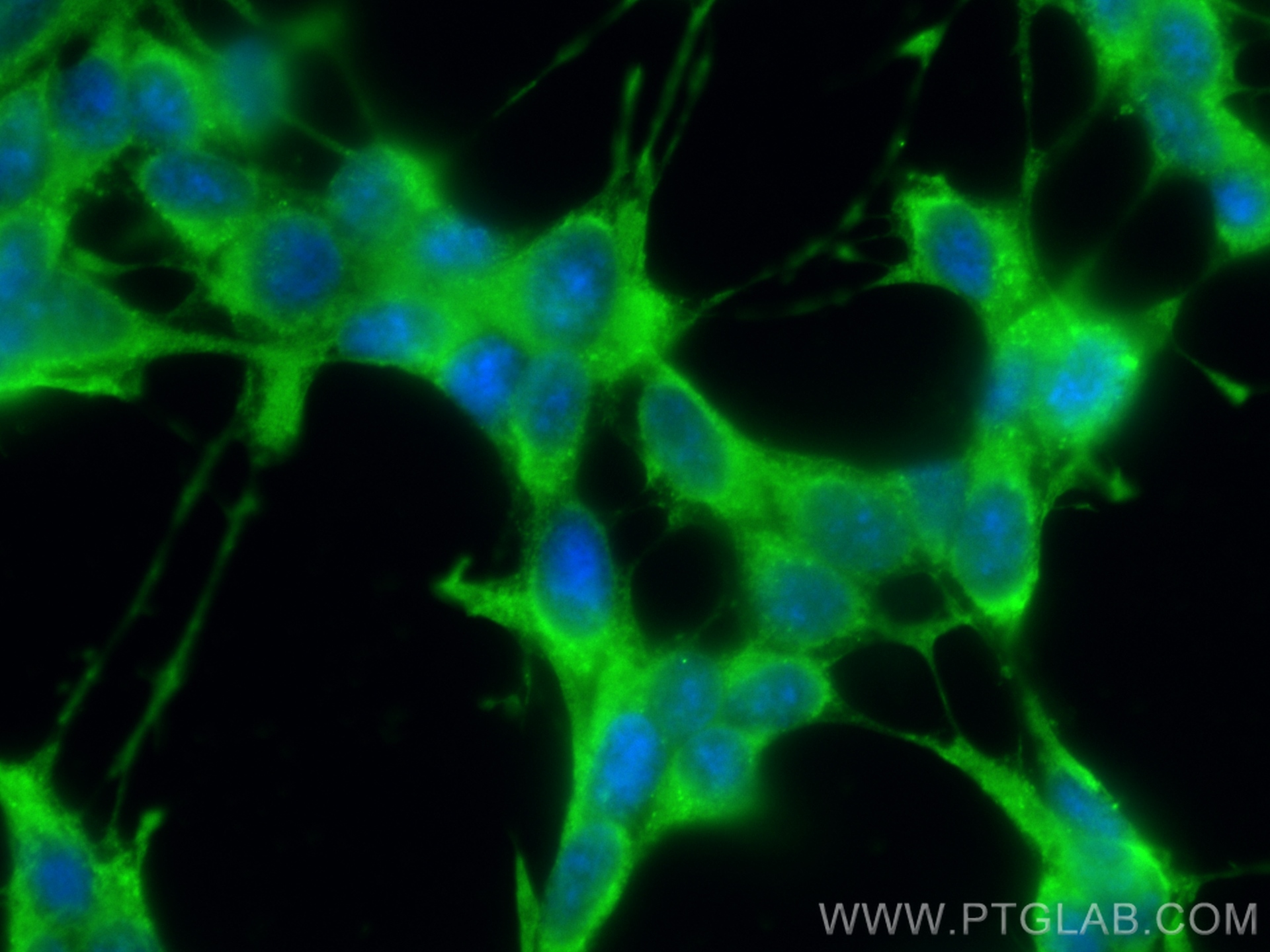 IF Staining of SH-SY5Y using 68846-1-Ig (same clone as 68846-1-PBS)