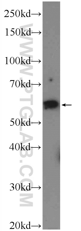 WB analysis of rat skeletal muscle using 17243-1-AP