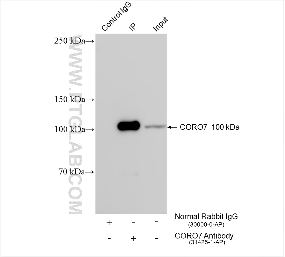 IP experiment of HeLa using 31425-1-AP